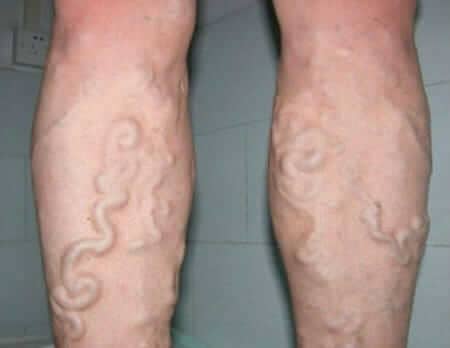 DiaFlex