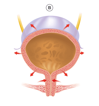 CYSTOBACT