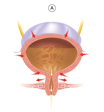 CYSTOBACT