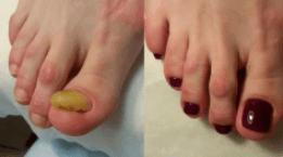 comment photo review