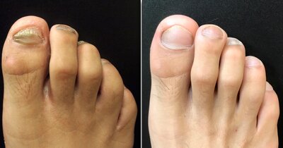 comment photo review