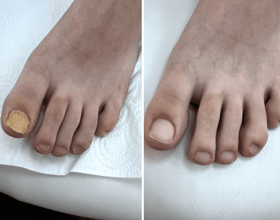 comment photo review