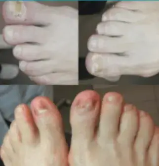 comment photo review