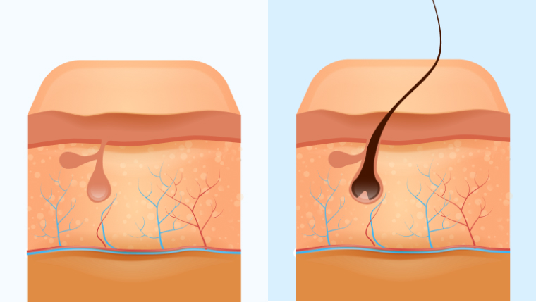 HRVATSKI CENTAR ZA ZDRAVLJE