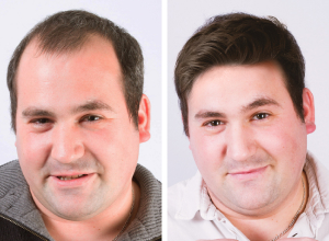 HRVATSKI CENTAR ZA ZDRAVLJE