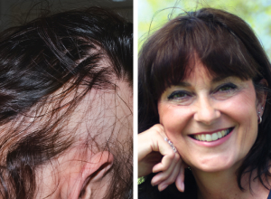 HRVATSKI CENTAR ZA ZDRAVLJE