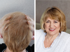 HRVATSKI CENTAR ZA ZDRAVLJE