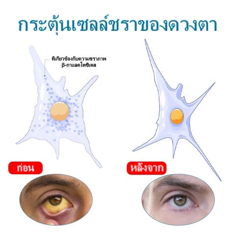 ATTDX Treatment EyeProblems SolutionDrops