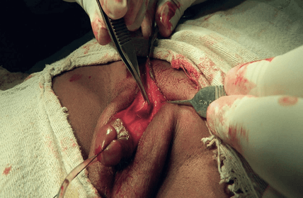 competitor visualisation