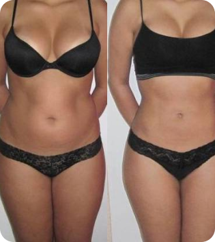 The result of using LIPOKETONIK our customer