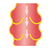 Arterin Max