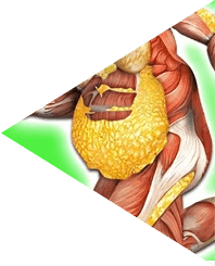 KetoSlim cream