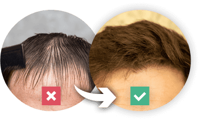 before and after use