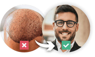 before and after use
