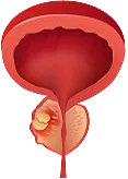 image bladder