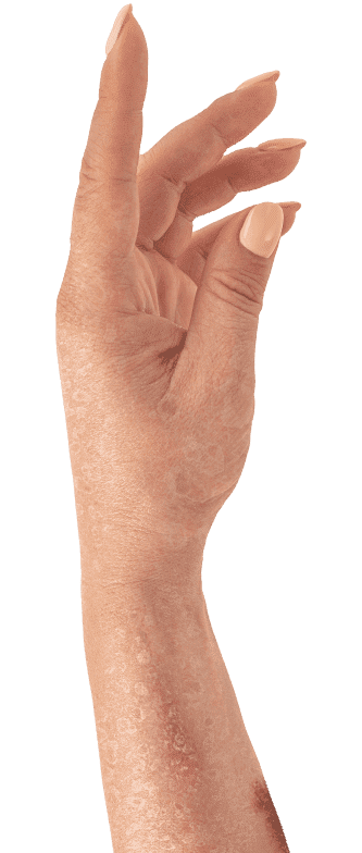 Yenki Derm
