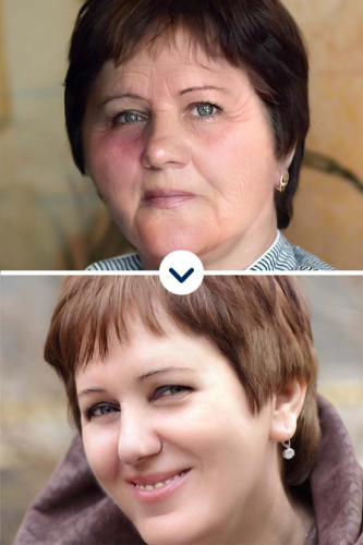 Biofit
