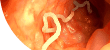 intestines.png