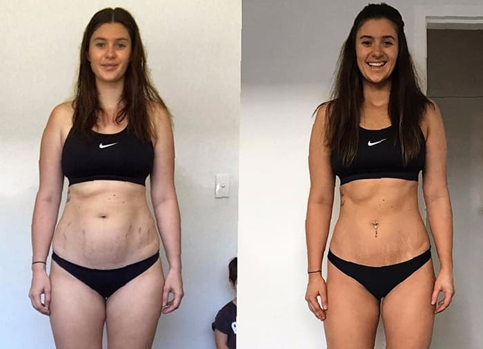 Woman's weight loss comparison photo
