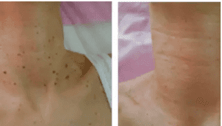 комментарийИзображение